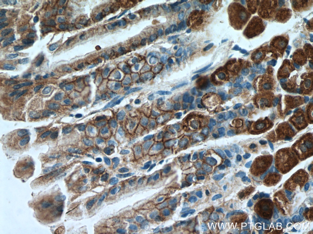Immunohistochemistry (IHC) staining of mouse stomach tissue using Ezrin Polyclonal antibody (26056-1-AP)