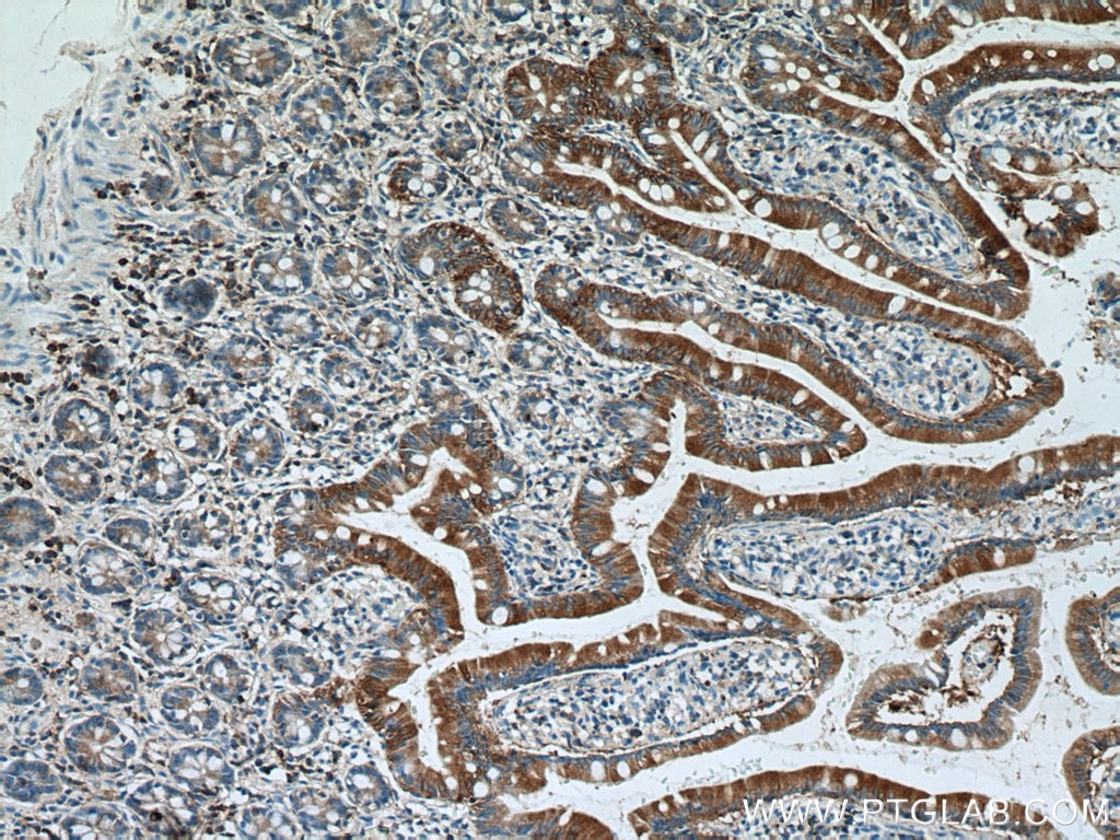 Immunohistochemistry (IHC) staining of human small intestine tissue using Ezrin Polyclonal antibody (26056-1-AP)