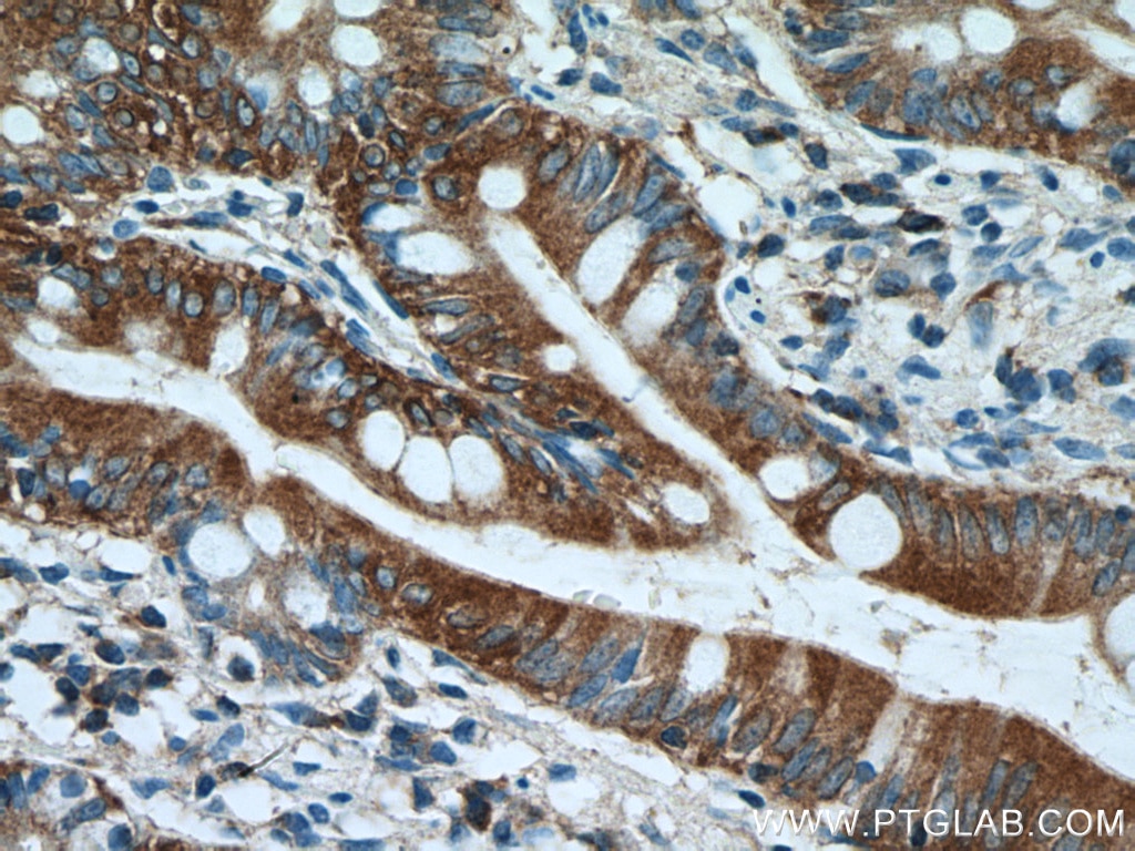 Immunohistochemistry (IHC) staining of human small intestine tissue using Ezrin Polyclonal antibody (26056-1-AP)