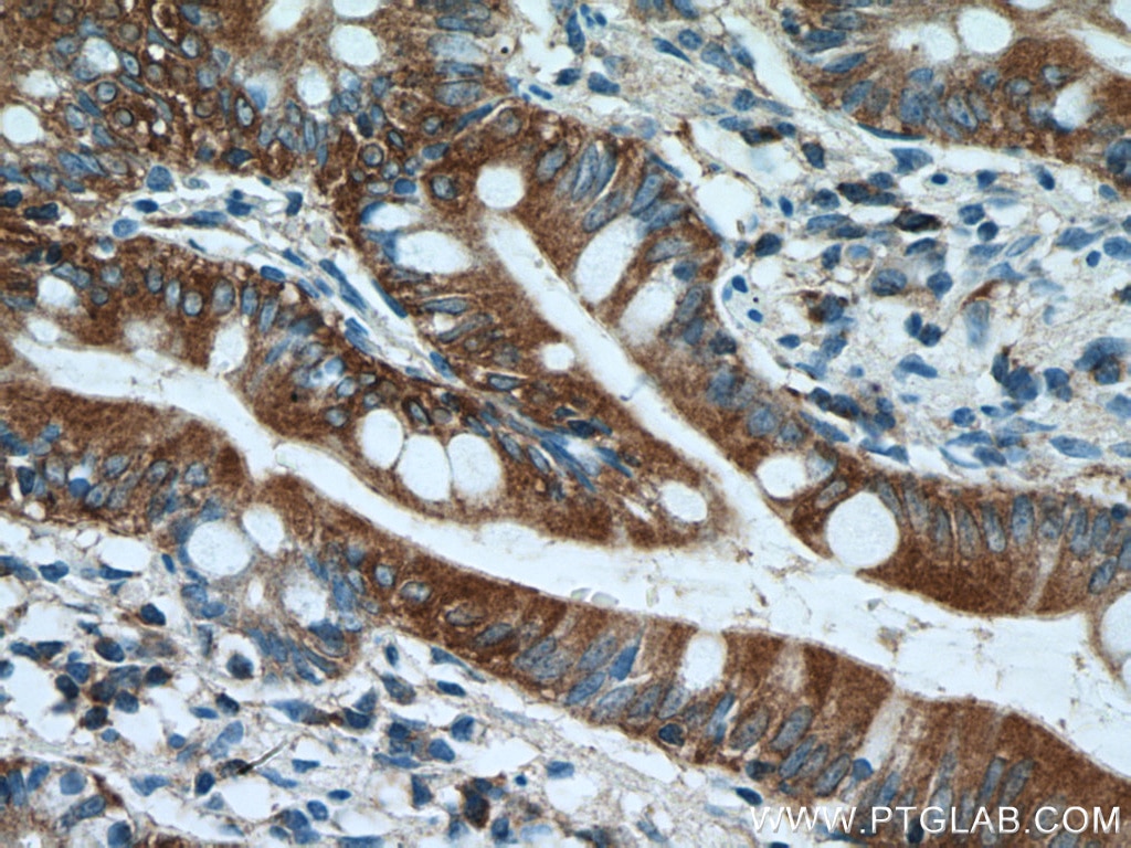 IHC staining of human small intestine using 26056-1-AP