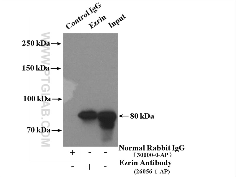 Immunoprecipitation (IP) experiment of HeLa cells using Ezrin Polyclonal antibody (26056-1-AP)