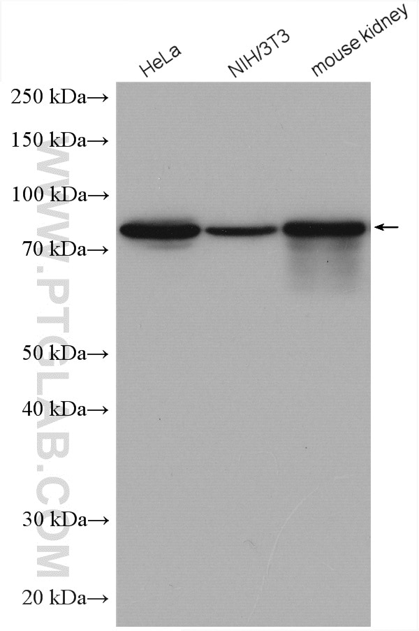 Western Blot (WB) analysis of various lysates using Ezrin Polyclonal antibody (26056-1-AP)