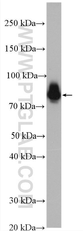 Western Blot (WB) analysis of HeLa cells using Ezrin Polyclonal antibody (26056-1-AP)