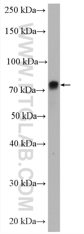 Western Blot (WB) analysis of mouse kidney tissue using Ezrin Polyclonal antibody (26056-1-AP)