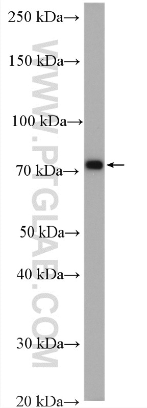 Western Blot (WB) analysis of NIH/3T3 cells using Ezrin Polyclonal antibody (26056-1-AP)
