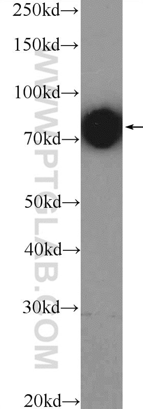 Ezrin Polyclonal antibody