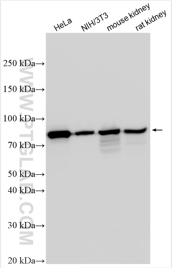 Western Blot (WB) analysis of various lysates using Ezrin Polyclonal antibody (26056-1-AP)