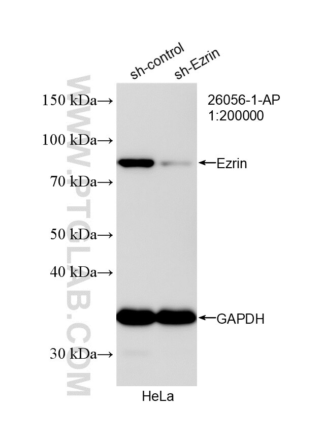 Western Blot (WB) analysis of HeLa cells using Ezrin Polyclonal antibody (26056-1-AP)
