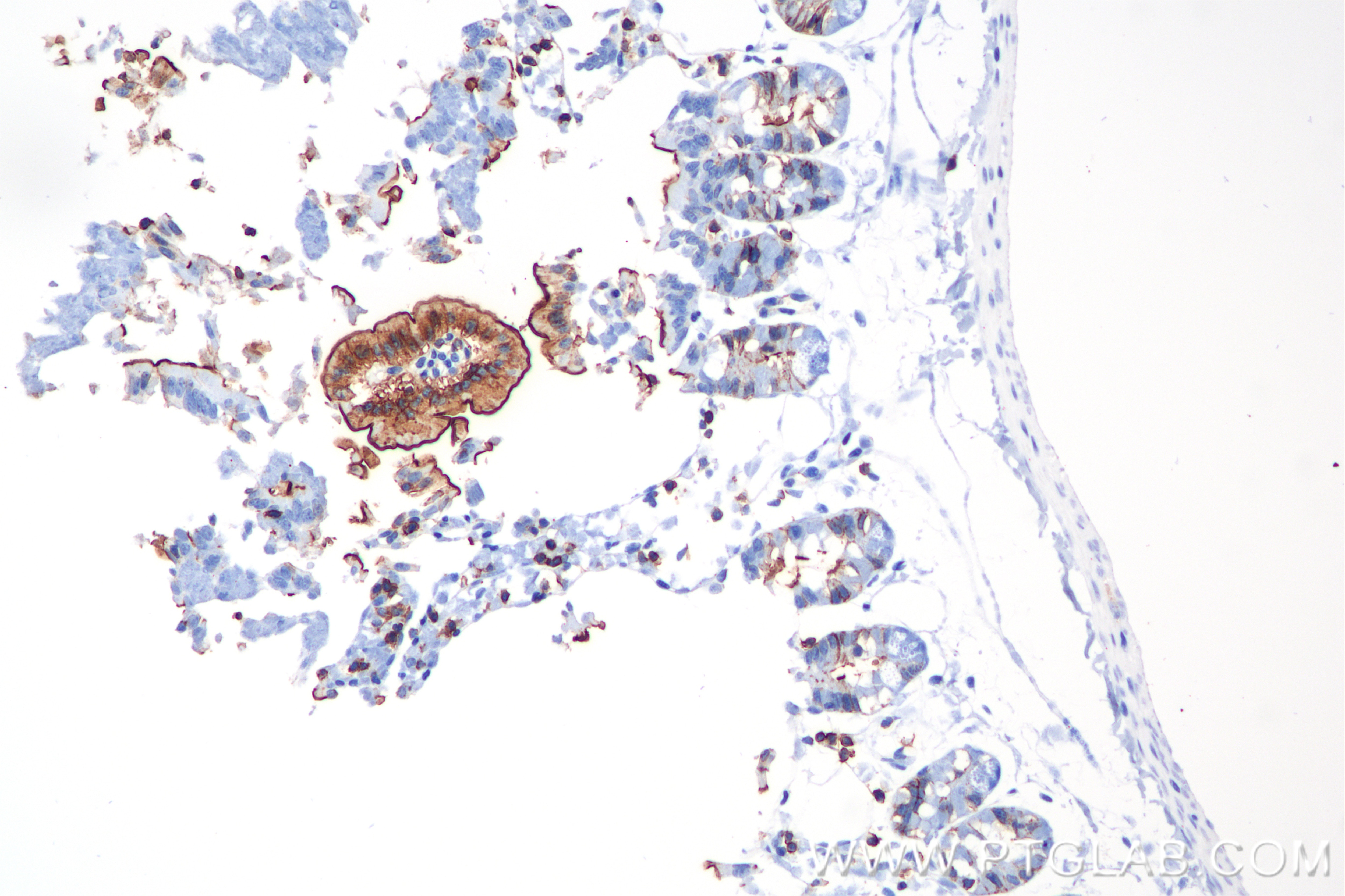 Immunohistochemistry (IHC) staining of Mouse small intestine tissue using Ezrin Recombinant antibody (85790-4-RR)