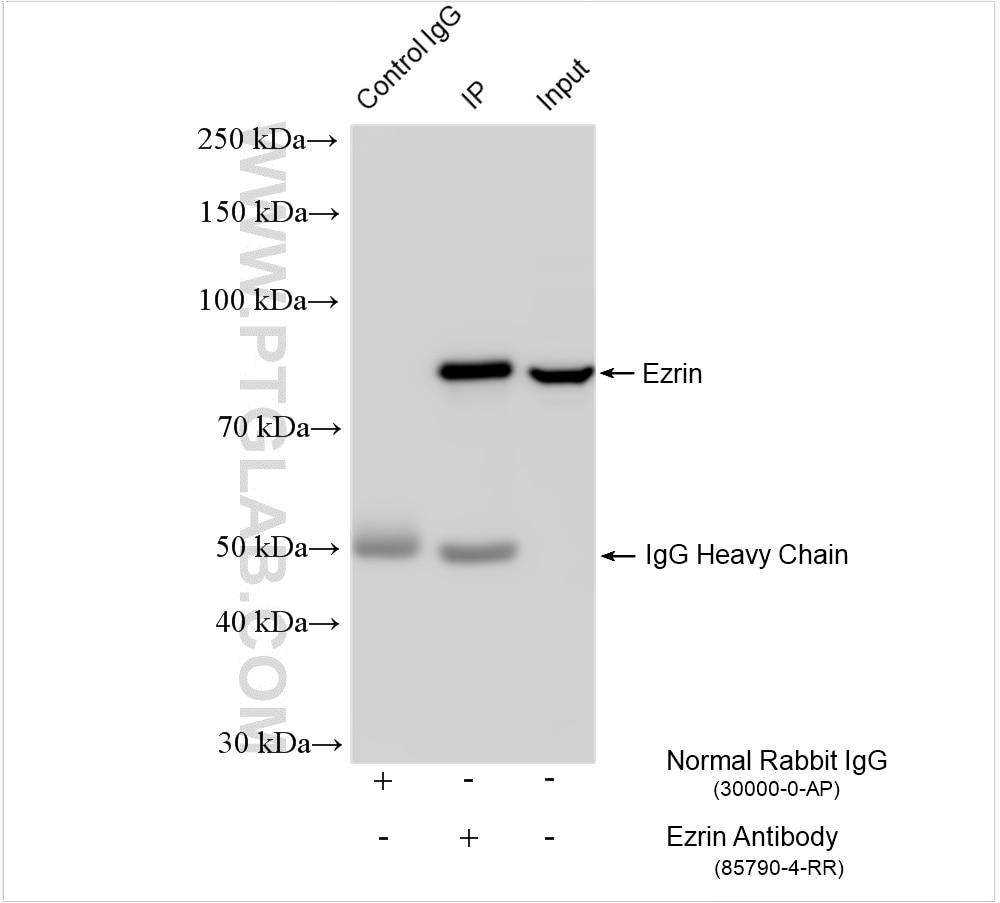 Immunoprecipitation (IP) experiment of HeLa cells using Ezrin Recombinant antibody (85790-4-RR)