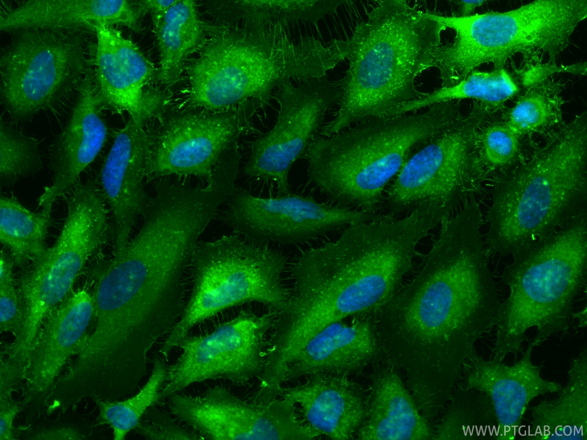 IF Staining of HeLa using CL488-85790-4 Immunofluorescence (IF) / fluorescent staining of HeLa cells using CoraLite® Plus 488-conjugated Ezrin Recombinant mo (CL488-85790-4)