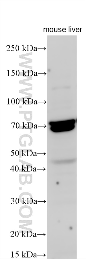 WB analysis using 24321-1-AP (same clone as 24321-1-PBS) Western Blot (WB) analysis of various lysates using FXI Polyclonal antibody (24321-1-AP)