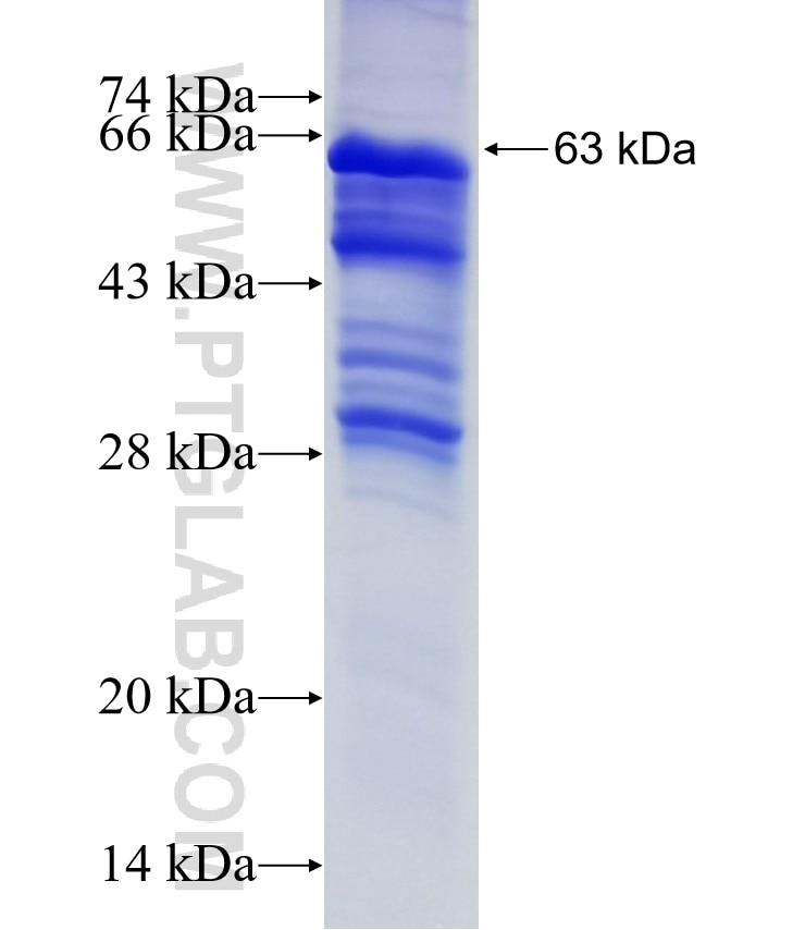 F11 fusion protein Ag18004 SDS-PAGE