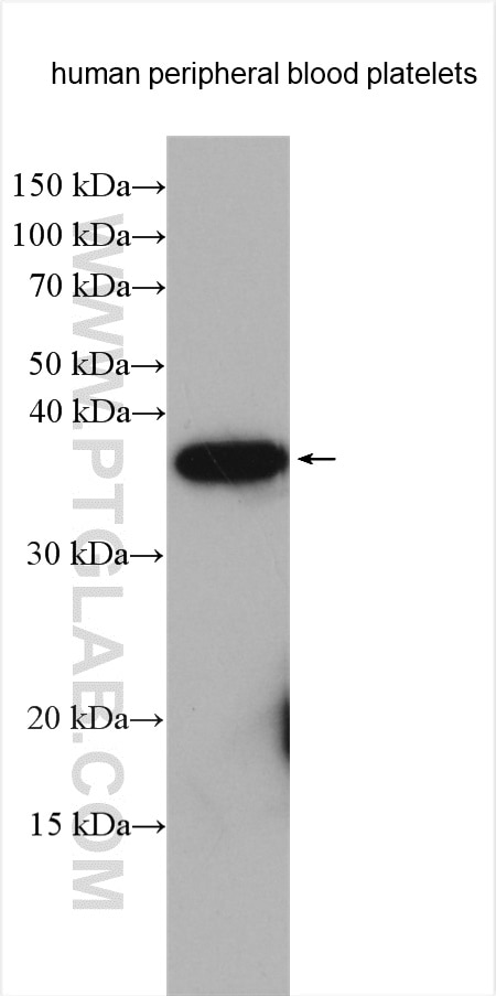 Western Blot (WB) analysis of various lysates using F11R Polyclonal antibody (16183-1-AP)