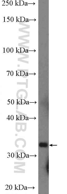 JAM-A/Junctional Adhesion Molecule A