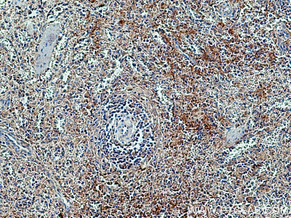 Immunohistochemistry (IHC) staining of human spleen tissue using F11R Polyclonal antibody (26941-1-AP)
