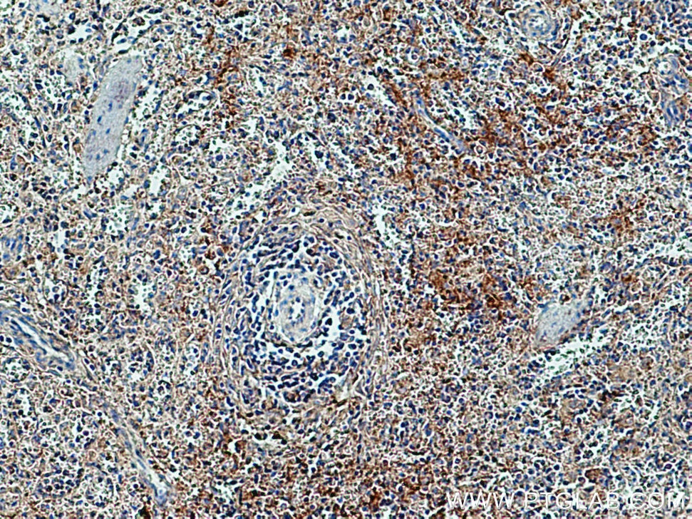 Immunohistochemistry (IHC) staining of human spleen tissue using JAM-A/Junctional Adhesion Molecule A Polyclonal an (26941-1-AP)