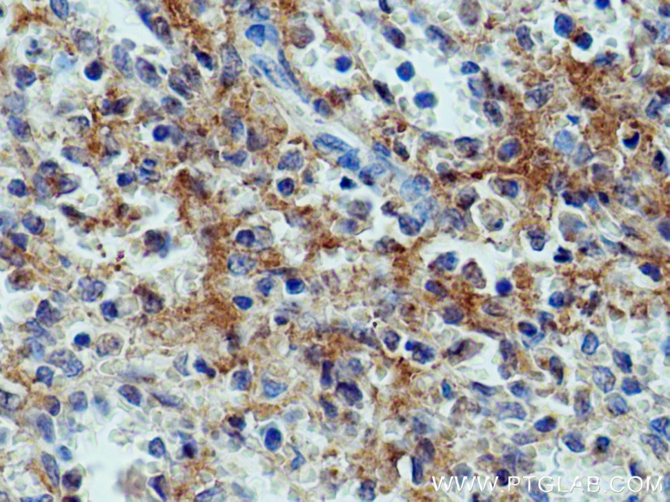 Immunohistochemistry (IHC) staining of human spleen tissue using F11R Polyclonal antibody (26941-1-AP)