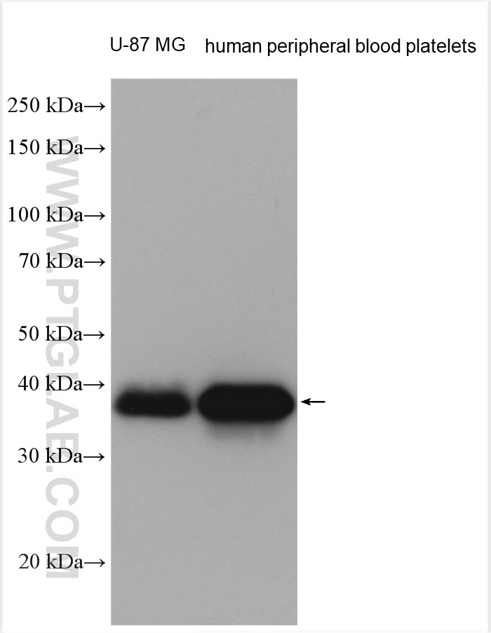 Western Blot (WB) analysis of various lysates using F11R Polyclonal antibody (26941-1-AP)