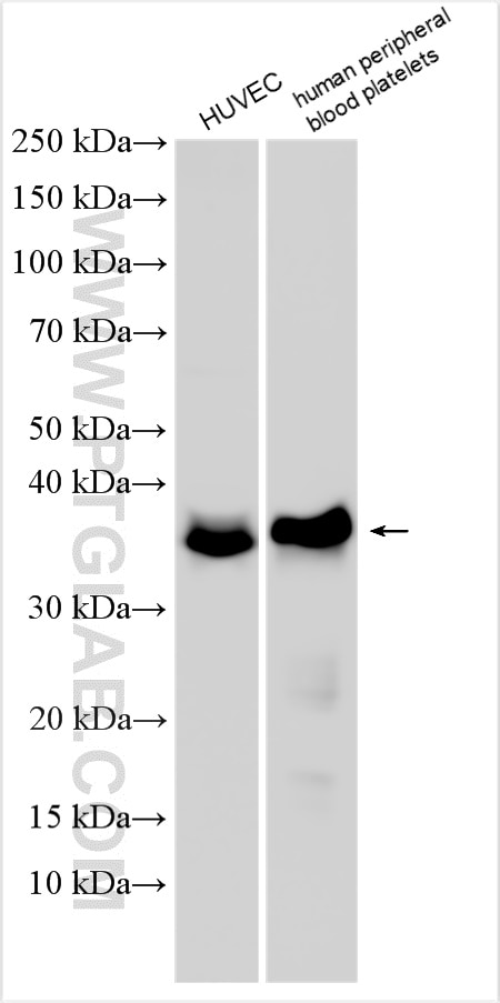 Western Blot (WB) analysis of various lysates using F11R Polyclonal antibody (26941-1-AP)