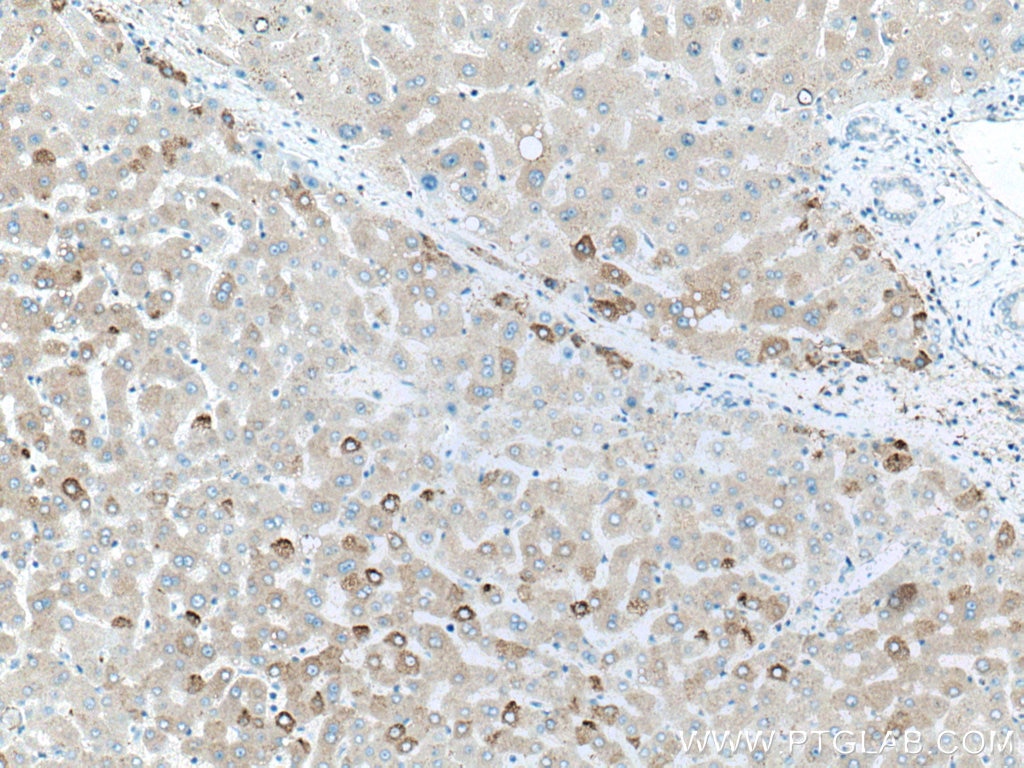 Immunohistochemistry (IHC) staining of human liver tissue using Factor XII Polyclonal antibody (12551-1-AP)