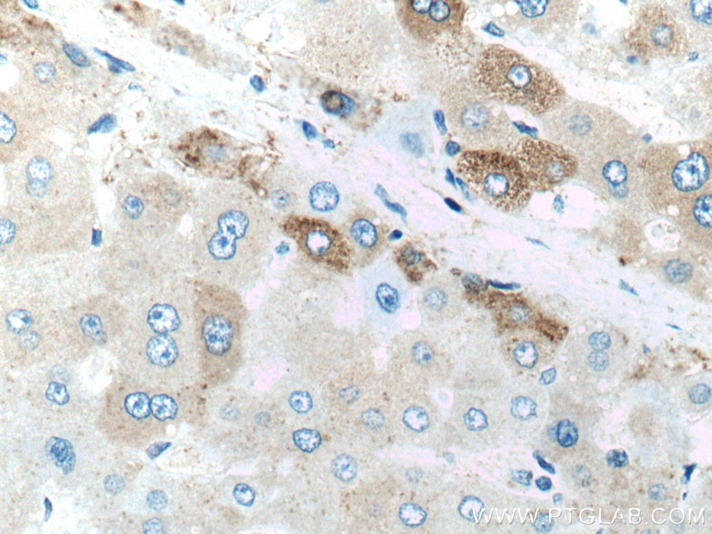Immunohistochemistry (IHC) staining of human liver tissue using Factor XII Polyclonal antibody (12551-1-AP)