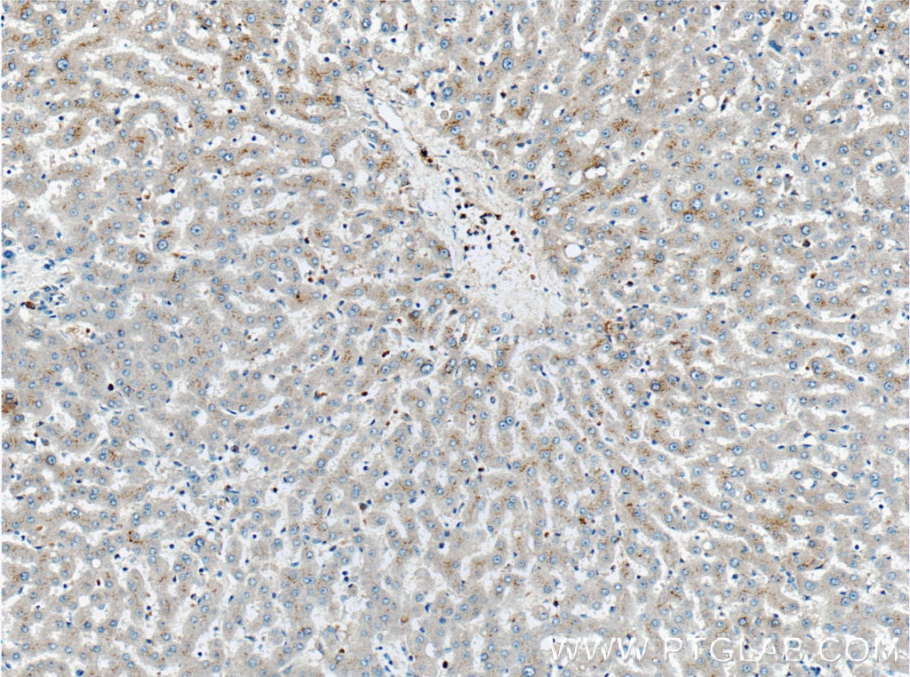 Immunohistochemistry (IHC) staining of human liver tissue using Factor XII Polyclonal antibody (27154-1-AP)