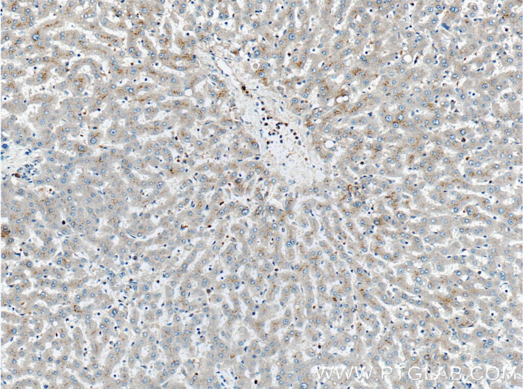 IHC staining of human liver using 27154-1-AP