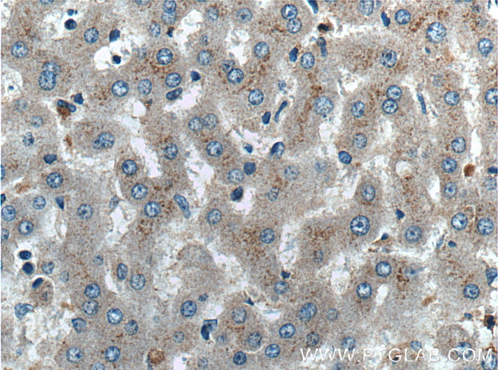 Immunohistochemistry (IHC) staining of human liver tissue using Factor XII Polyclonal antibody (27154-1-AP)