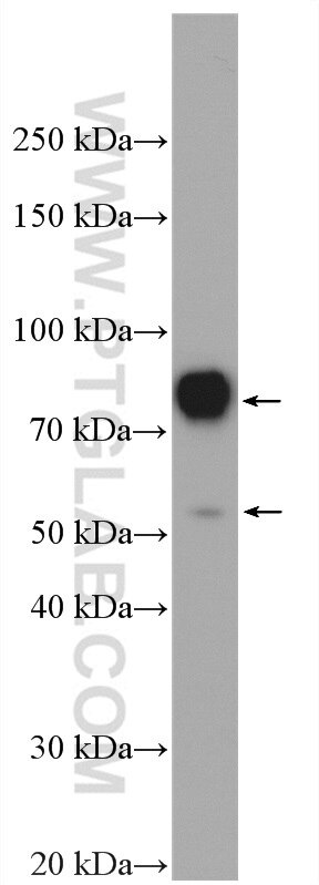 Factor XII