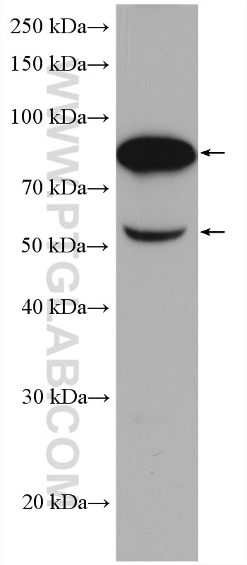 Western Blot (WB) analysis of human plasma using Factor XII Polyclonal antibody (27154-1-AP)