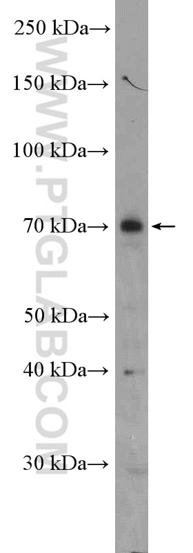 Western Blot (WB) analysis of Jurkat cells using Factor XII Polyclonal antibody (27154-1-AP)