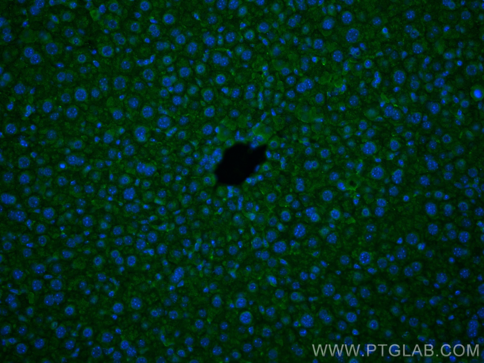 Immunofluorescence (IF) / fluorescent staining of mouse liver tissue using Factor XII Monoclonal antibody (66089-1-Ig)