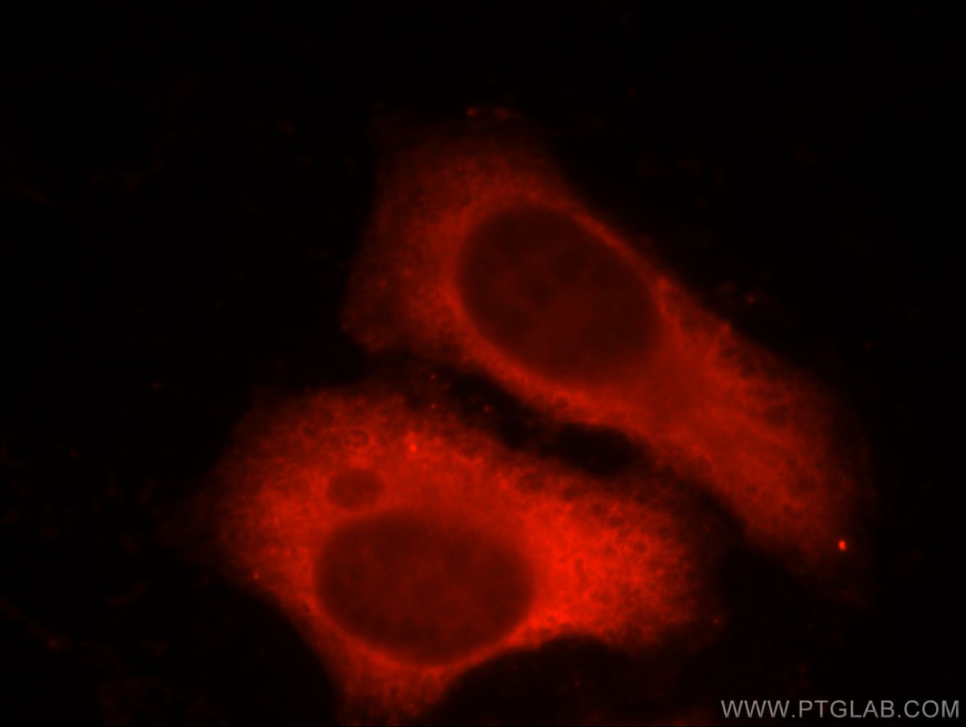 IF Staining of HepG2 using 66089-1-Ig