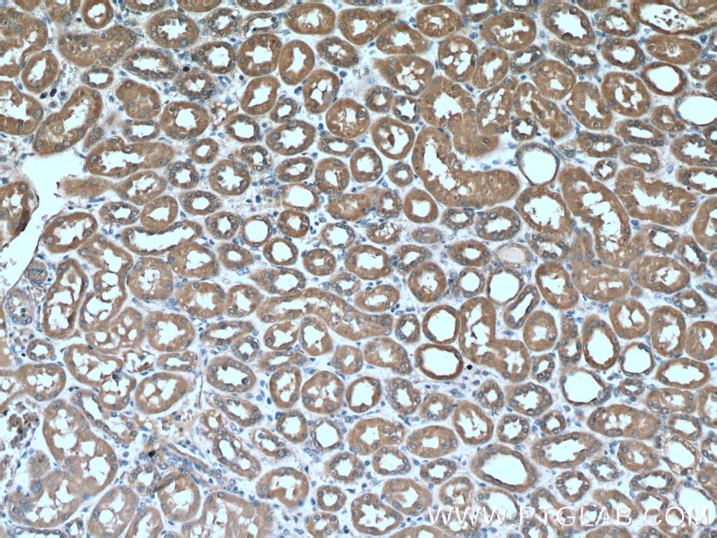 Immunohistochemistry (IHC) staining of human kidney tissue using Factor XII Monoclonal antibody (66089-1-Ig)