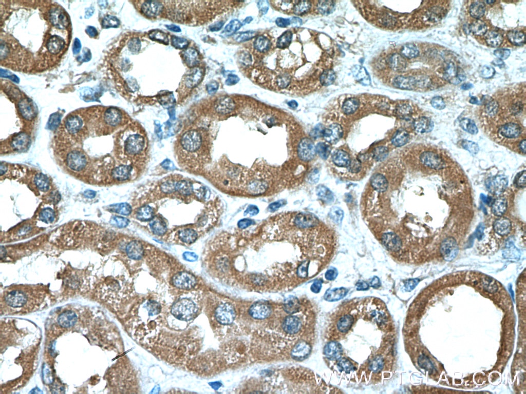 Immunohistochemistry (IHC) staining of human kidney tissue using Factor XII Monoclonal antibody (66089-1-Ig)