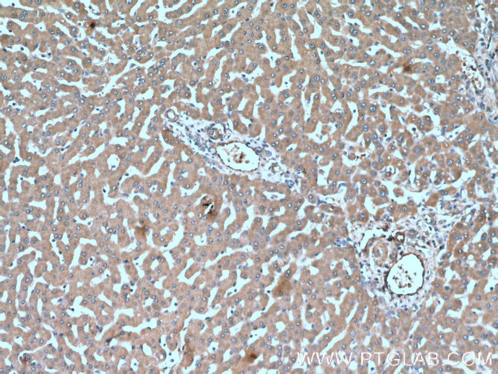 Immunohistochemistry (IHC) staining of human liver tissue using Factor XII Monoclonal antibody (66089-1-Ig)