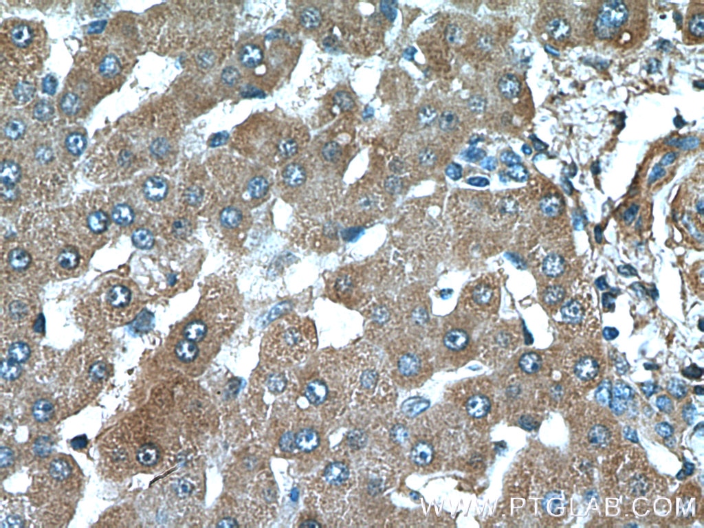 Immunohistochemistry (IHC) staining of human liver tissue using Factor XII Monoclonal antibody (66089-1-Ig)