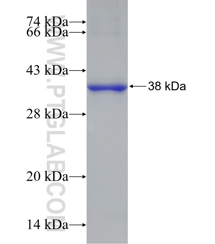 F12 fusion protein Ag3401 SDS-PAGE