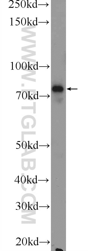 Western Blot (WB) analysis of mouse lung tissue using Factor XIIIa Polyclonal antibody (17223-1-AP)