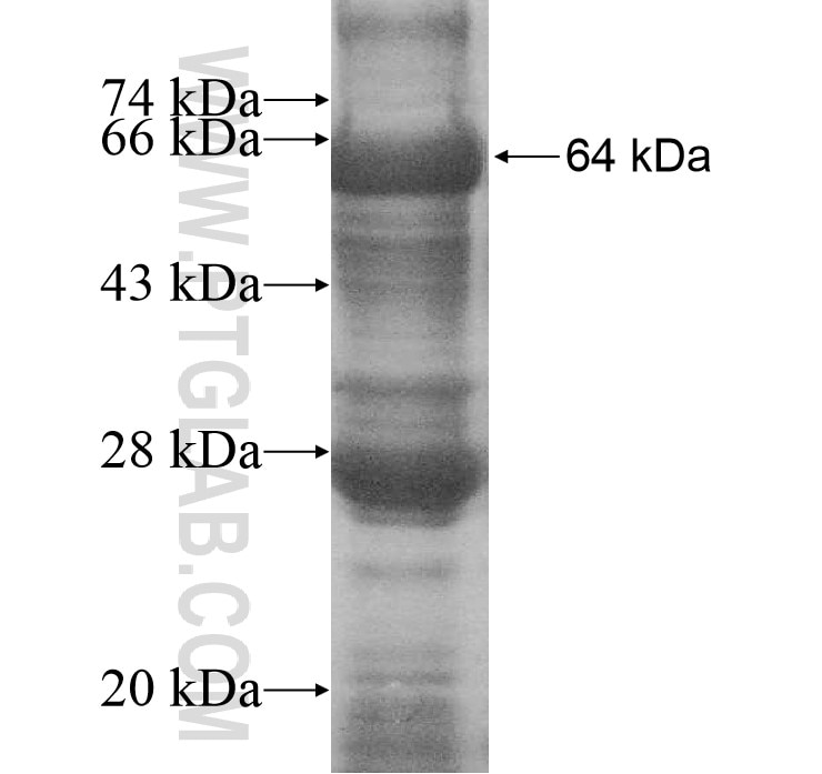 F13A1 fusion protein Ag11059 SDS-PAGE
