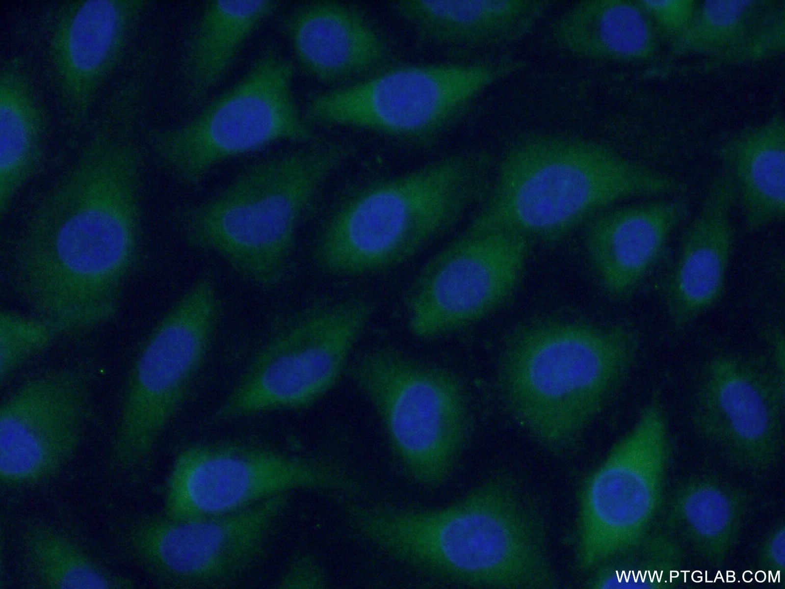 Immunofluorescence (IF) / fluorescent staining of HUVEC cells using Coagulation Factor II Polyclonal antibody (24295-1-AP)