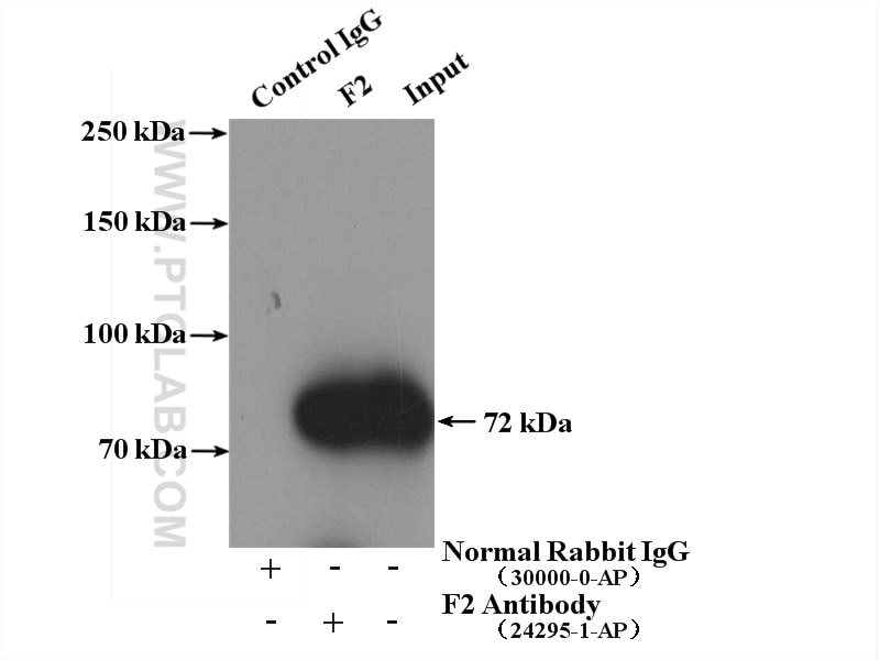 Immunoprecipitation (IP) experiment of human plasma using F2 Polyclonal antibody (24295-1-AP)