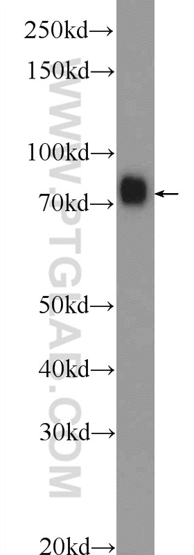 Western Blot (WB) analysis of human plasma using F2 Polyclonal antibody (24295-1-AP)