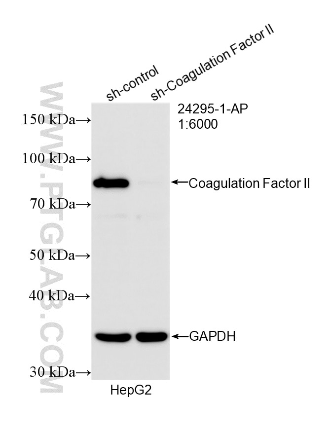 Western Blot (WB) analysis of HepG2 cells using Coagulation Factor II Polyclonal antibody (24295-1-AP)