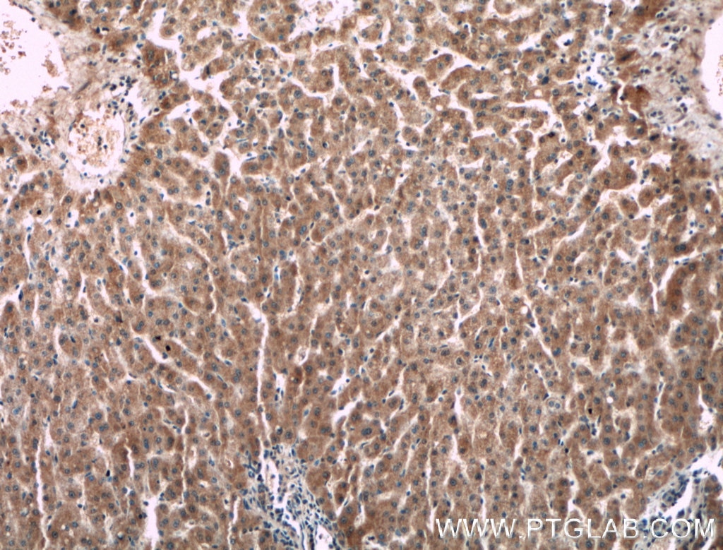 Immunohistochemistry (IHC) staining of human liver tissue using F2 Monoclonal antibody (66509-1-Ig)