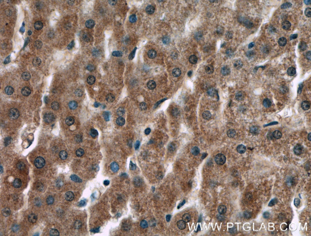 Immunohistochemistry (IHC) staining of human liver tissue using F2 Monoclonal antibody (66509-1-Ig)