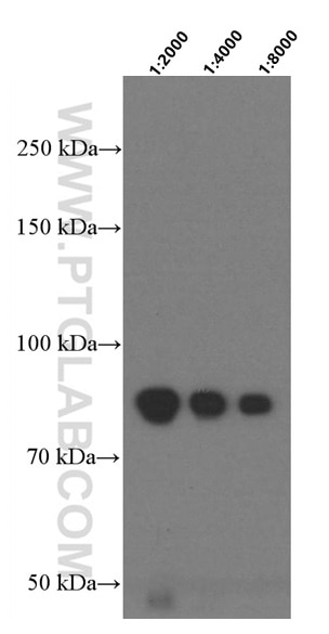 Western Blot (WB) analysis of human plasma using F2 Monoclonal antibody (66509-1-Ig)