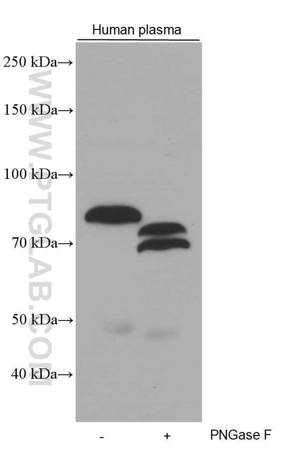 Western Blot (WB) analysis of human plasma using Coagulation Factor II Monoclonal antibody (66509-1-Ig)
