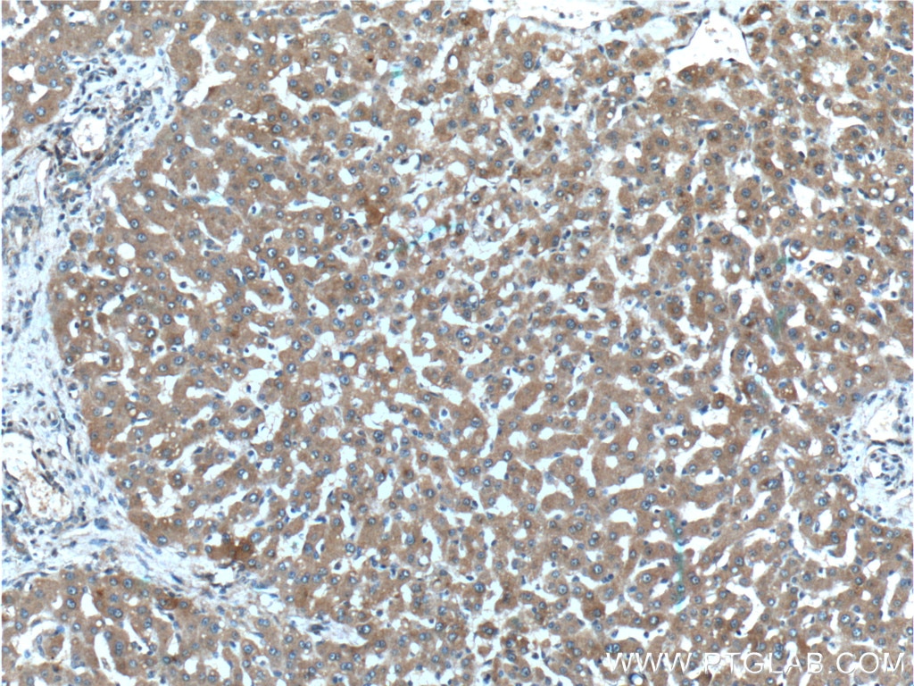 Immunohistochemistry (IHC) staining of human liver tissue using PAR1/Thrombin Receptor Polyclonal antibody (26366-1-AP)